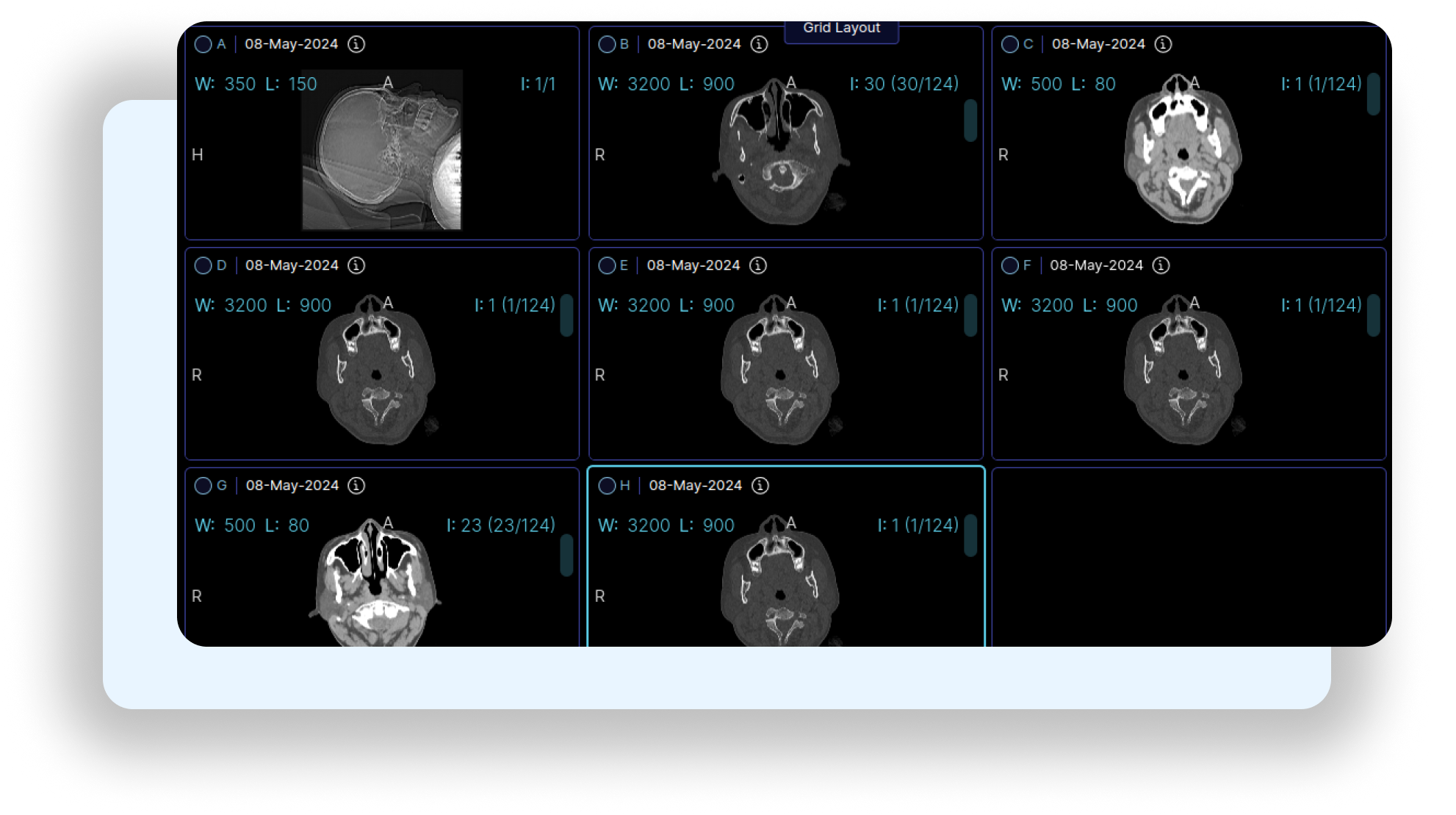 patient worklist management in pacs imaging software